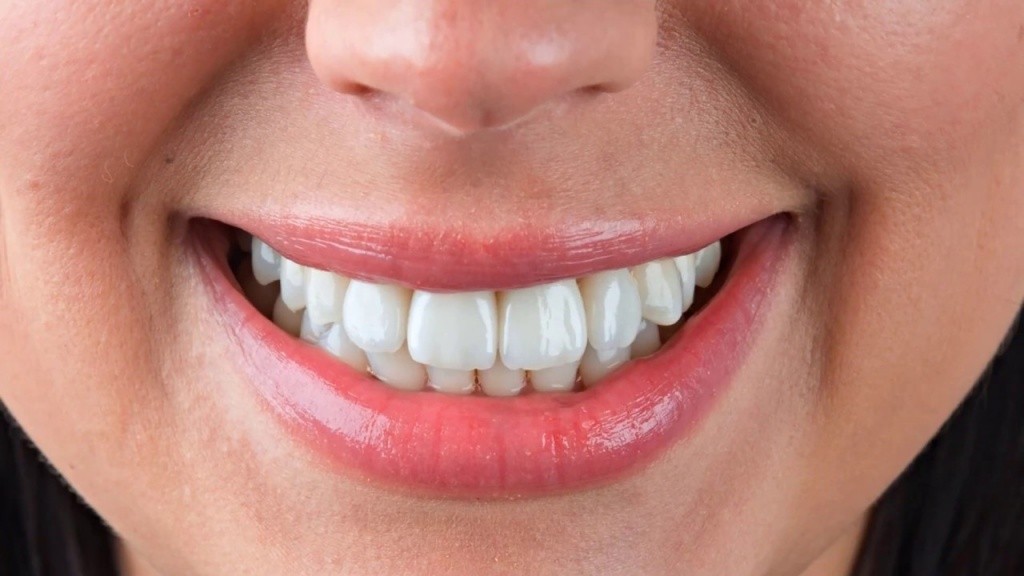 Как следить за эстетикой зубов