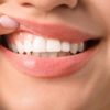 Избавиться от налёта на зубах и избежать образования кариеса (практический совет, в домашних условиях)