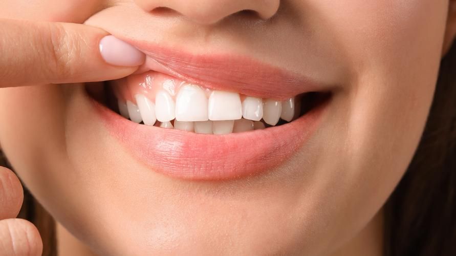 Избавиться от налёта на зубах и избежать образования кариеса (практический совет, в домашних условиях)